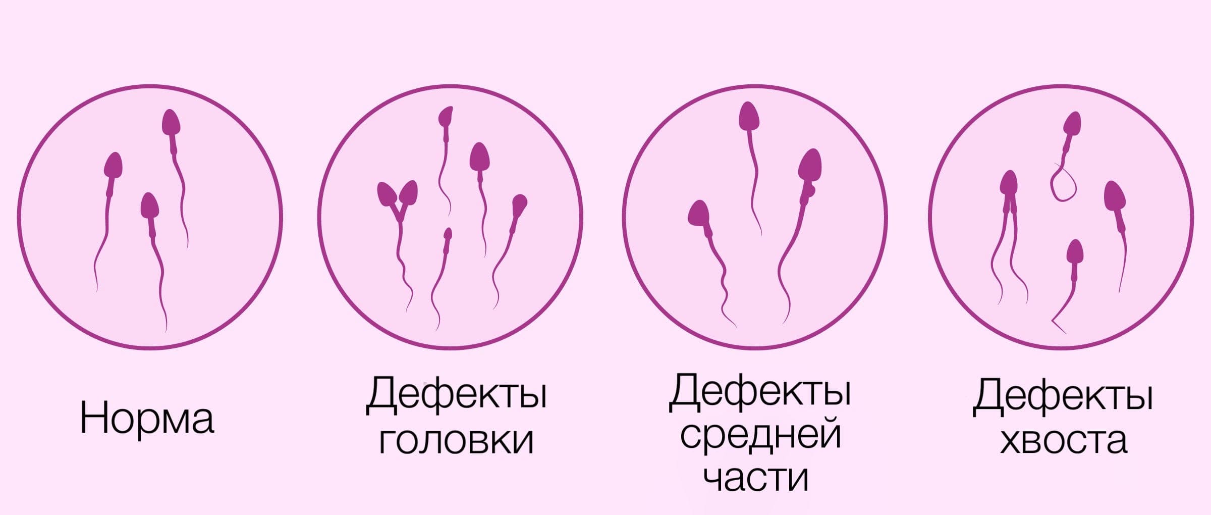 строение человеческого сперматозоида