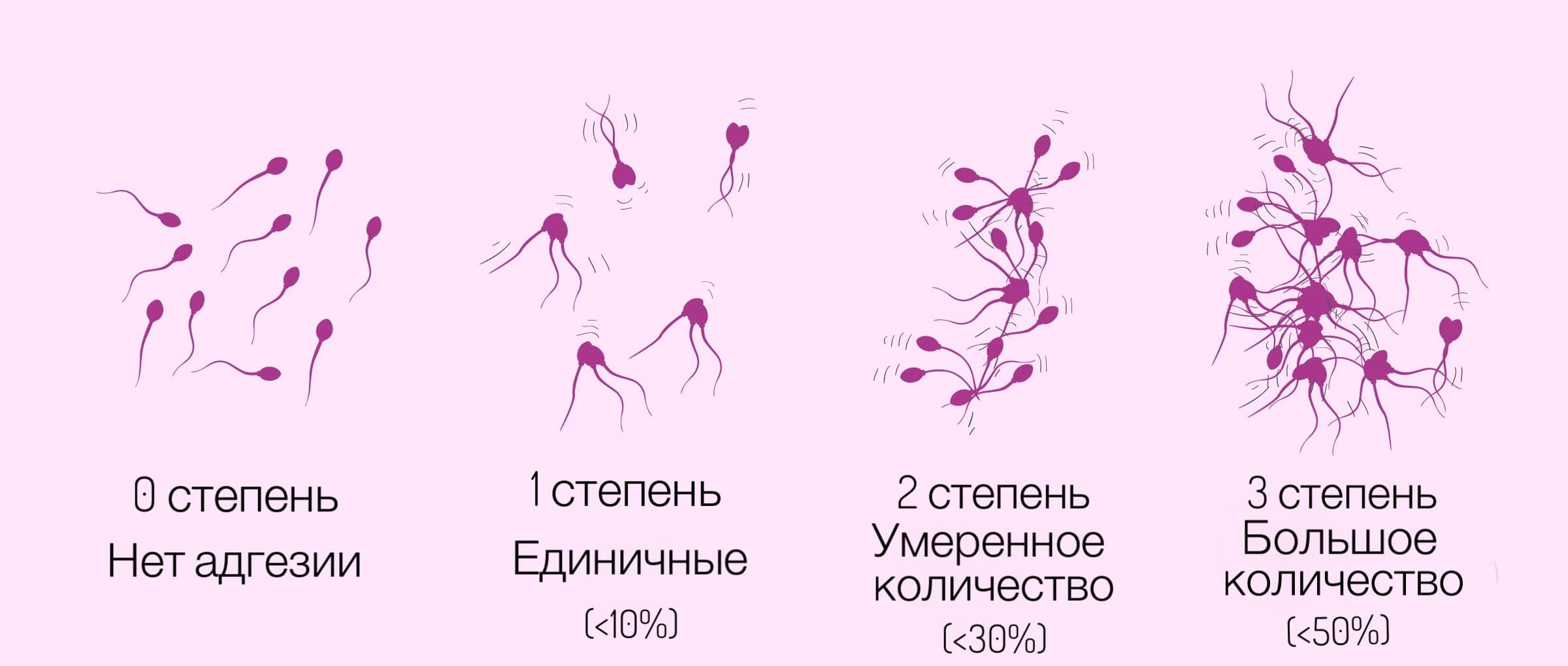строение мужского сперматозоида