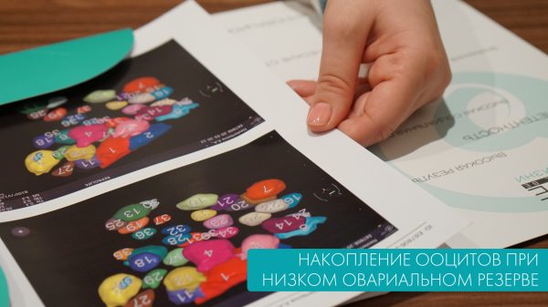 Накопление ооцитов при низком овариальном резерве