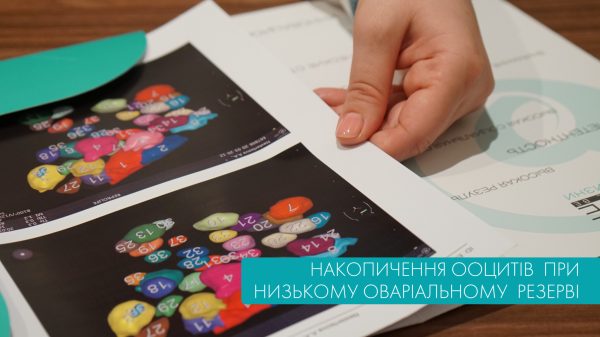 Накопичення ооцитів при низькому оваріальному резерві
