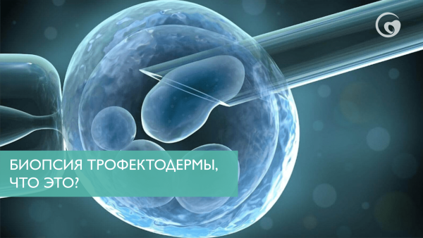 Биопсия трофектодермы, что это?