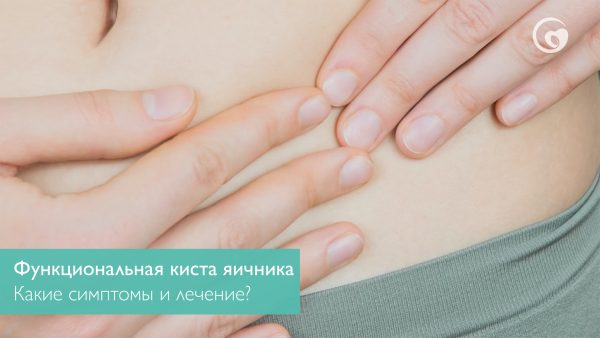 Что такое функциональная киста яичника? Какие ее симптомы и лечение?
