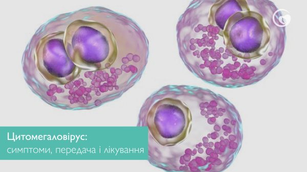 Цитомегаловірус: симптоми, передача і лікування