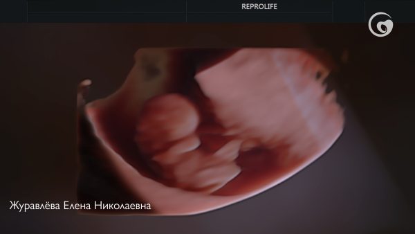 Часто задаваемые вопросы о движениях малыша во время беременности