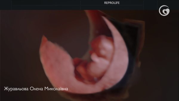 Поширені питання про рухи малюка під час вагітності. Частина 2