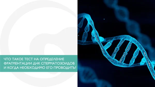 ДНК фрагментация сперматозоидов