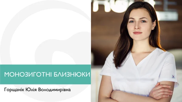 Монозиготні близнюки