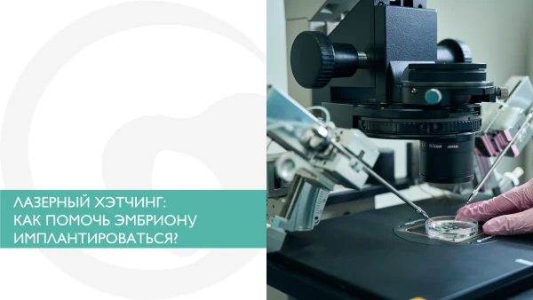 ЛАЗЕРНЫЙ ХЭТЧИНГ